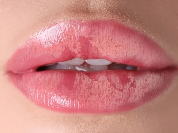 Illustration: lips before lip blushing
